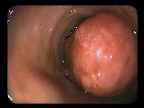 anal polyp photographs Japanese sex outside at night